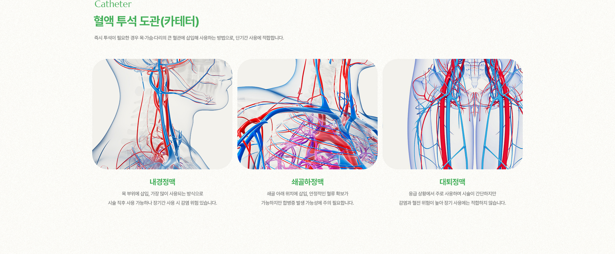 혈액 투석 도관(카테터) | 즉시 투석이 필요한 경우 목·가슴·다리의 큰 혈관에 삽입해 사용하는 방법으로, 단기간 사용에 적합합니다.